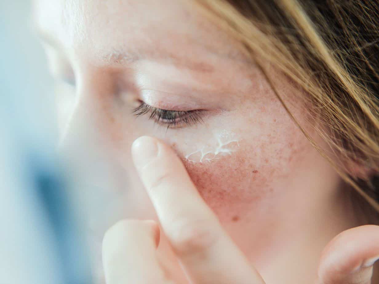 Causes of dry skin around the eyes 01 