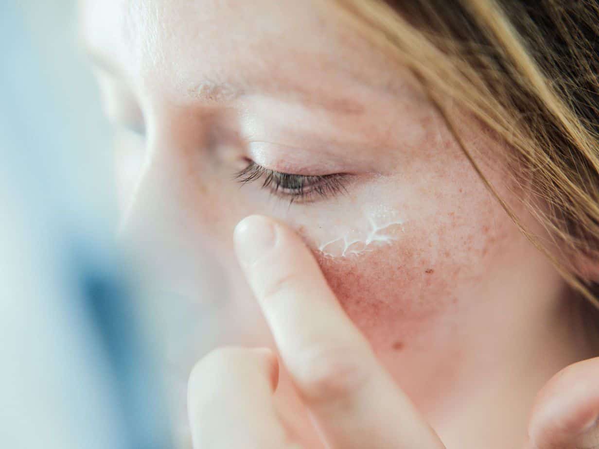 Causes of white patches on the face