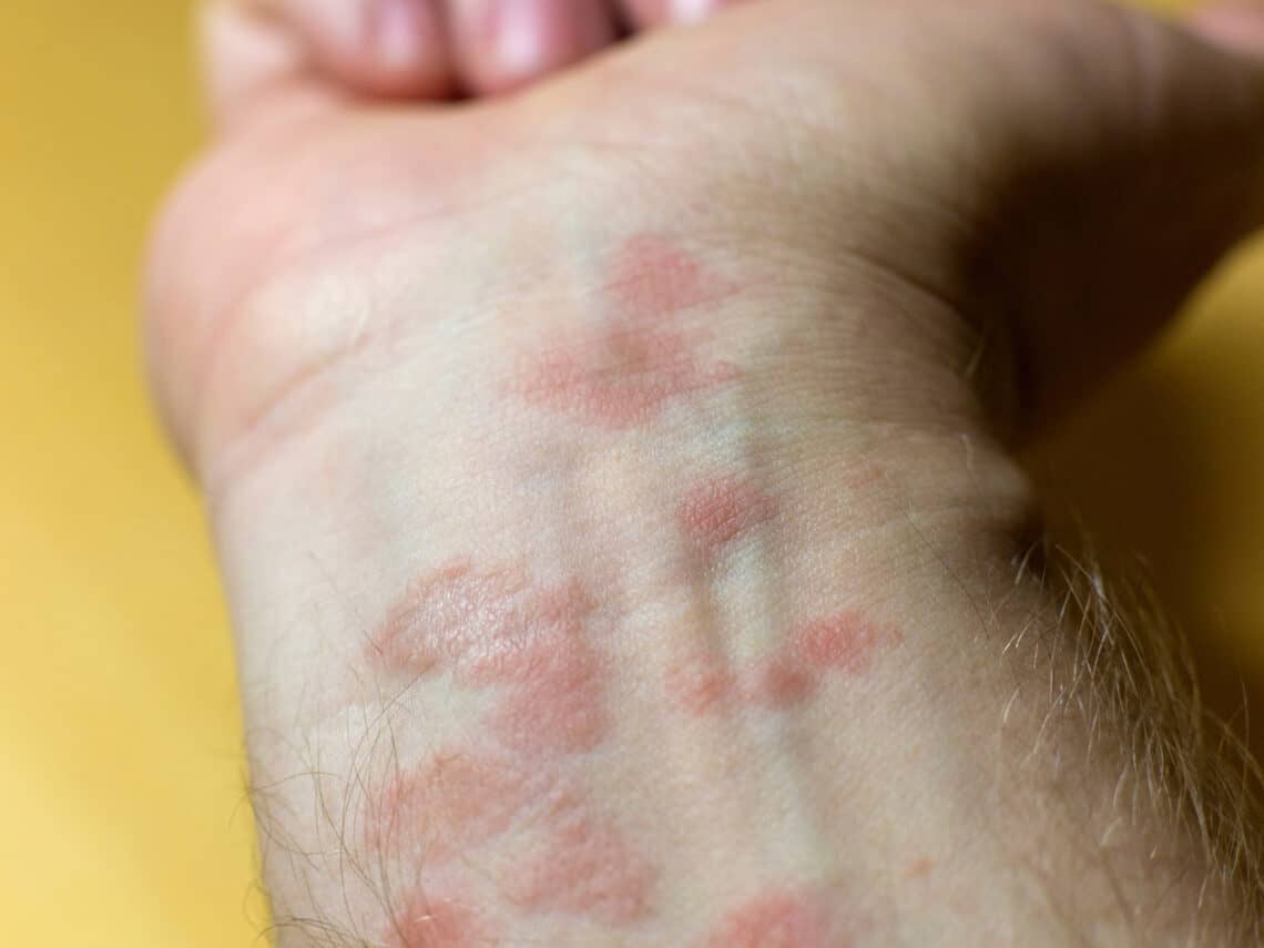 red spots on skin pictures