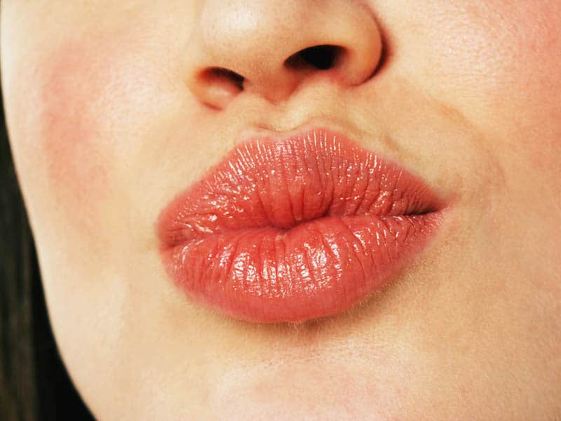 How to Remove Dark Spots on Lips Naturally Fast
