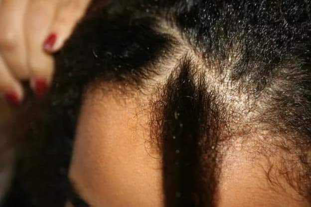 Divide your hair into small cornrow section