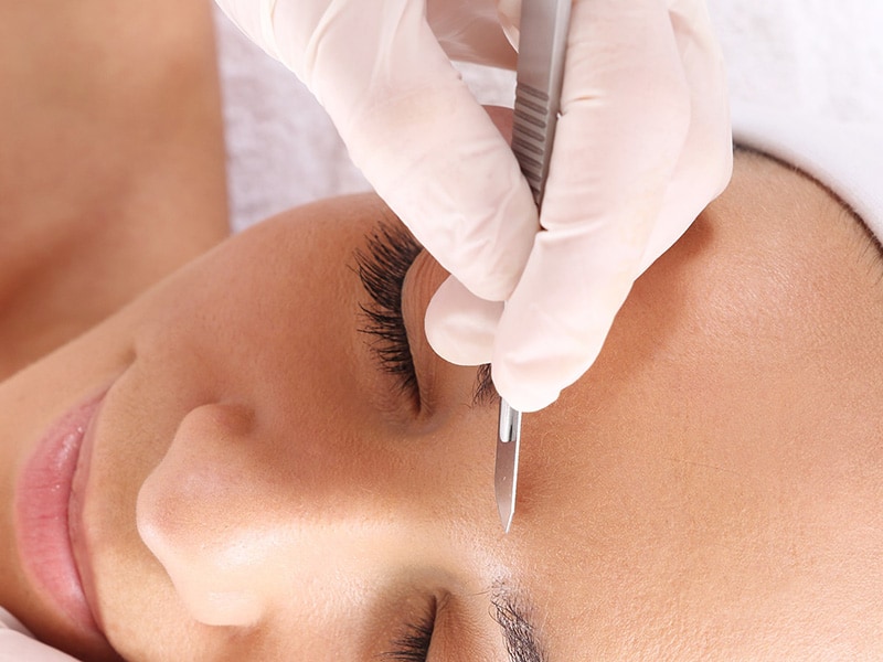 What are the benefits of dermaplaning? 