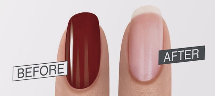 Your nail before and after removal